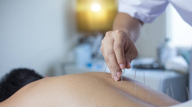 Behandlung mit traditioneller chinesischer Medizin - Akupunktur