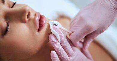 Lip Filler Frankfurt_eraesthetic.de